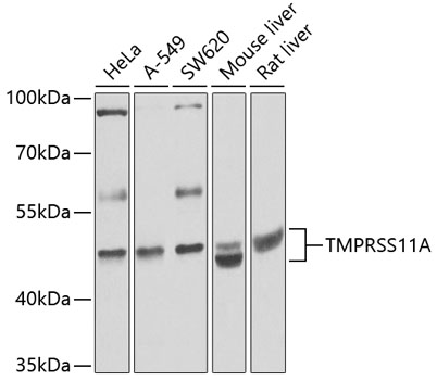 TMPRSS11A Polyclonal Antibody