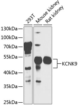 KCNK9 Polyclonal Antibody