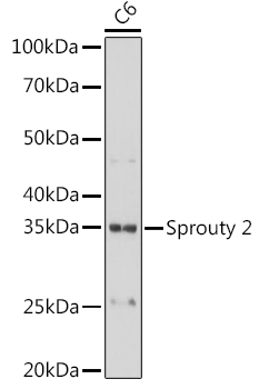 Sprouty 2 Monoclonal Antibody [10M8H1]