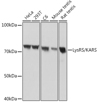 LysRS/KARS Monoclonal Antibody [2V2B6]
