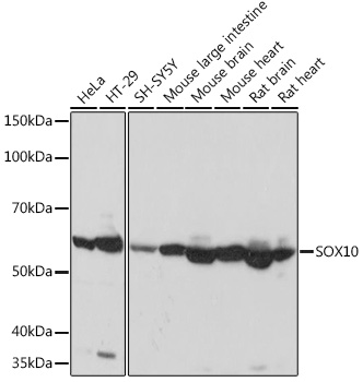 SOX10 Monoclonal Antibody [2V5D6]