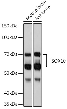 SOX10 Monoclonal Antibody [3Y3P1]