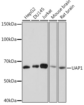 UAP1 Monoclonal Antibody [5S7M2]