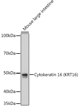 Cytokeratin 16 (KRT16) Monoclonal Antibody [8L6R4]