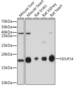 NDUFS4 Monoclonal Antibody [6T10F4]