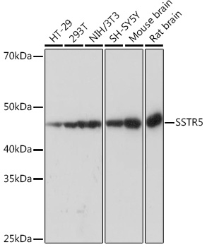 SSTR5 Monoclonal Antibody [4O6N5]