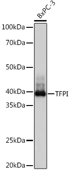 TFPI Monoclonal Antibody [5J8X8]