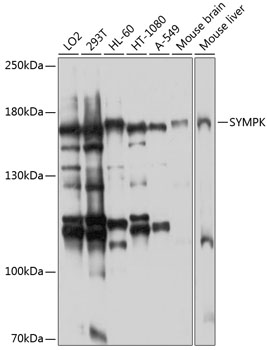 SYMPK Polyclonal Antibody