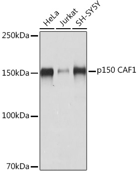 p150 CAF1 Monoclonal Antibody [1T1O5]