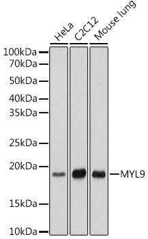 MYL9 Monoclonal Antibody [4C9E8]