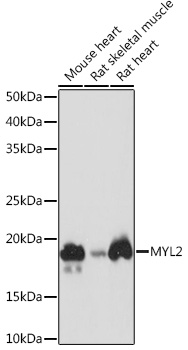 MYL2 Monoclonal Antibody [5M6Q8]