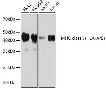 MHC class I (HLA-A/B) Monoclonal Antibody [3I1C1]