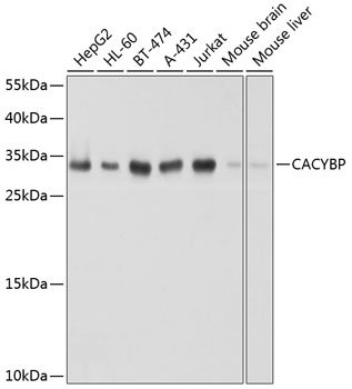 CACYBP Polyclonal Antibody