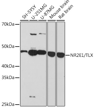 NR2E1/TLX Monoclonal Antibody [6P3H8]