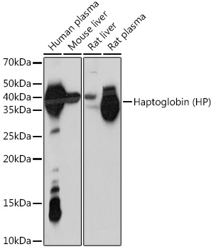 Haptoglobin (HP) Monoclonal Antibody [7C1N2]
