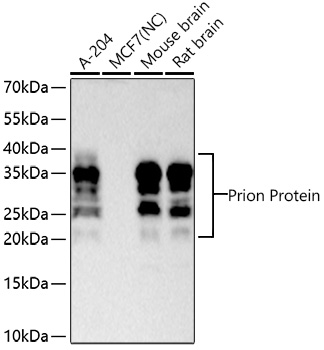 Prion Protein Monoclonal Antibody [3D0J9]
