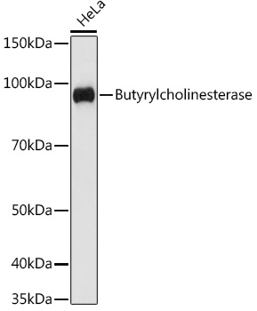 Butyrylcholinesterase Monoclonal Antibody [4N2N9]