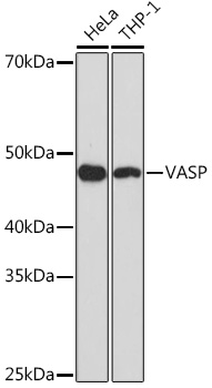 VASP Monoclonal Antibody [6Q3M0]