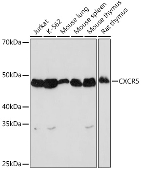 CXCR5 Monoclonal Antibody [9Q10I2]