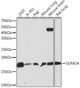 SUMO4 Monoclonal Antibody [7X3V7]
