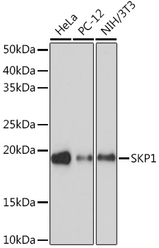 SKP1 Monoclonal Antibody [10G5X5]