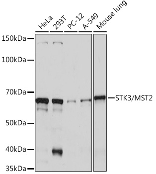 STK3/MST2 Monoclonal Antibody [5J1I4]
