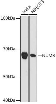 NUMB Monoclonal Antibody [9X1Y0]