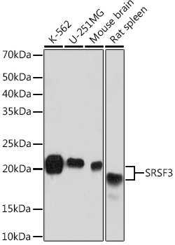 SRSF3 Monoclonal Antibody [9A1Z4]