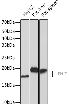 FHIT Monoclonal Antibody [3Z1U4]
