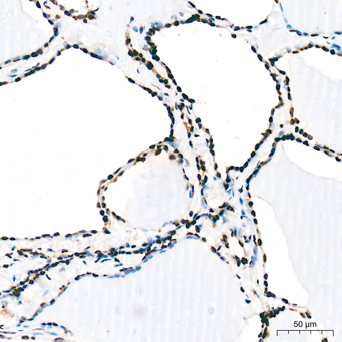 FUBP1 Monoclonal Antibody [1G6X5]