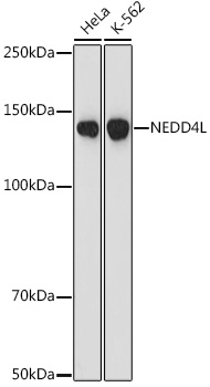 NEDD4L Monoclonal Antibody [3W9J2]