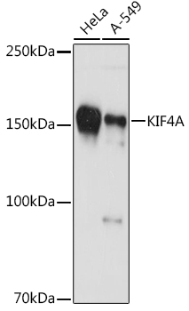 KIF4A Monoclonal Antibody [4A9P2]