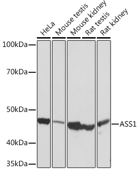 ASS1 Monoclonal Antibody [4W1M8]
