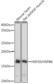 HSP20/HSPB6 Monoclonal Antibody [3J5N1]