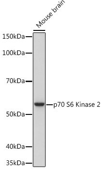 p70 S6 Kinase 2 Monoclonal Antibody [5D8F5]