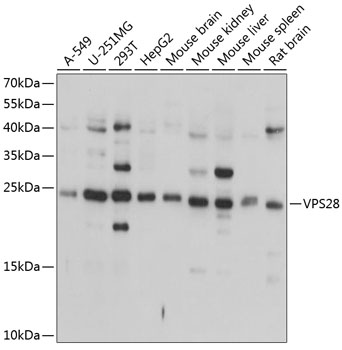 VPS28 Polyclonal Antibody