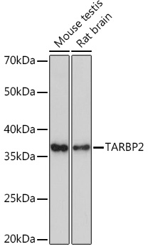 TARBP2 Monoclonal Antibody [9E6C9]