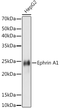 Ephrin A1 Monoclonal Antibody [5D4Q5]
