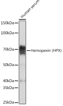 Hemopexin (HPX) Monoclonal Antibody [1M6O3]