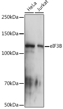 eIF3B Monoclonal Antibody [4T9V1]