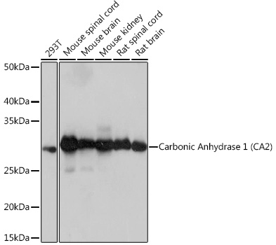 Carbonic Anhydrase 2 (CA2) Monoclonal Antibody [9P5W9]
