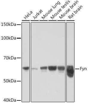 Fyn Monoclonal Antibody [7Z9F2]