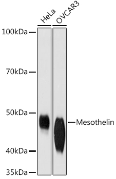 Mesothelin Monoclonal Antibody [5R9H8]