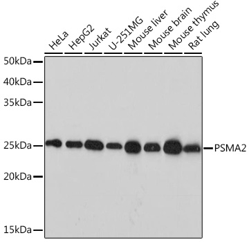 PSMA2 Monoclonal Antibody [6L5H4]