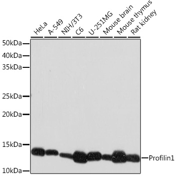 Profilin1 Monoclonal Antibody [2Z1M4]