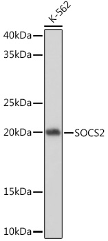 SOCS2 Monoclonal Antibody [6D3F6]