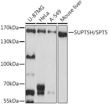 SUPT5H/SPT5 Polyclonal Antibody