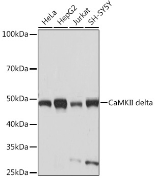 CaMKII delta Monoclonal Antibody [10M1P2]