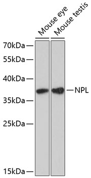 NPL Polyclonal Antibody