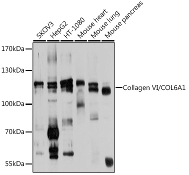Collagen VI/COL6A1 Polyclonal Antibody